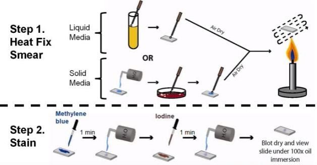 How Do You Do The New Methylene Blue Procedure?